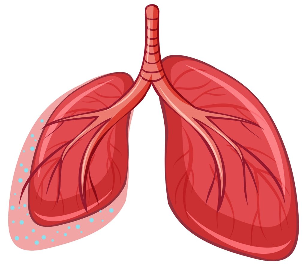 Complicazioni respiratorie e Charcot-Marie-Tooth