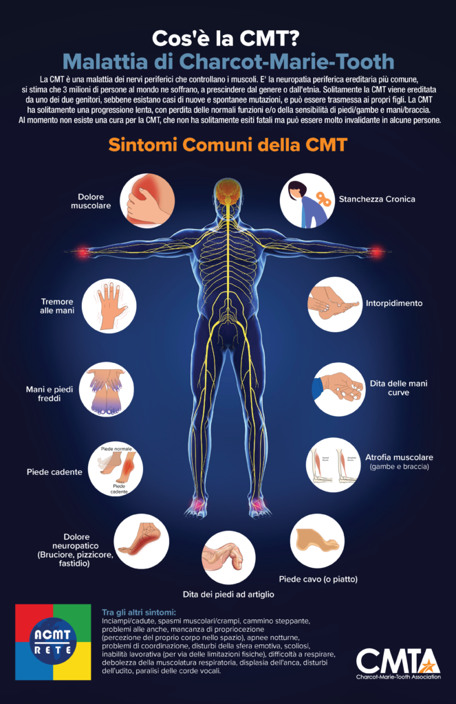 I Sintomi più comuni della Charcot-Marie-Tooth