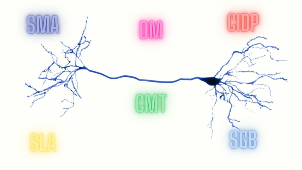 Neurone con i vari acronimi delle più comuni malattie neuromuscolari