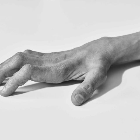 Mani con CMT nella mostra di Aliteia The Ballad of Human Mutations
