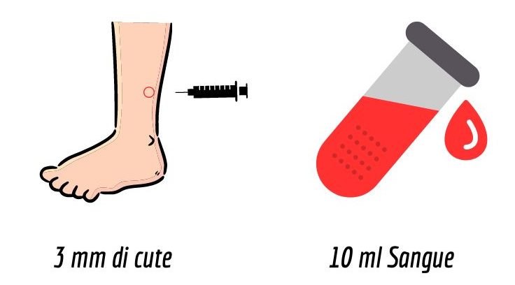 Prelievo di cute e sangue per studio biomarcatori CMT1A