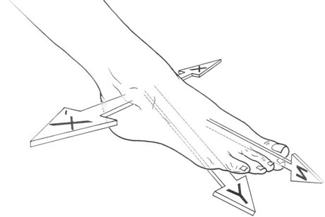 La correzione sui tre piani di movimento della caviglia è fondamentale per la CMT